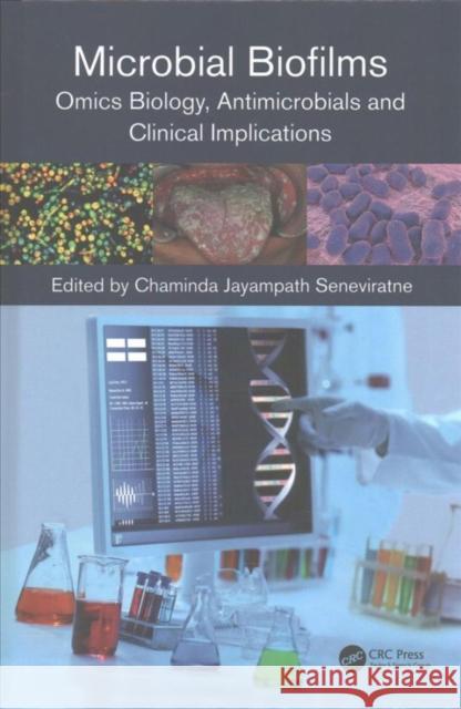 Microbial Biofilms: Omics Biology, Antimicrobials and Clinical Implications Chaminda Jayampath Seneviratne 9781498722193 CRC Press