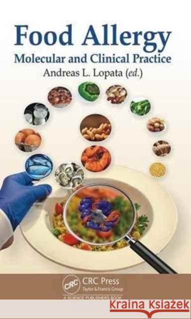 Food Allergy: Molecular and Clinical Practice Andreas L. Lopata 9781498722445 CRC Press