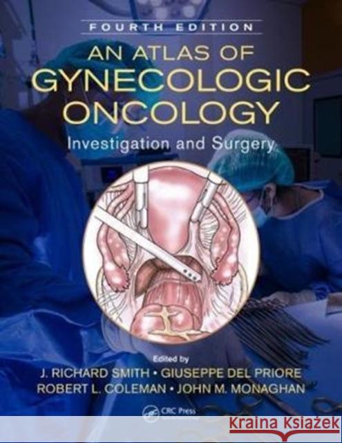 An Atlas of Gynecologic Oncology: Investigation and Surgery, Fourth Edition J. Richard Smith Giuseppe de Robert L. Coleman 9781498729062 CRC Press