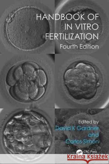 Handbook of in Vitro Fertilization Gardner, David K. 9781498729390