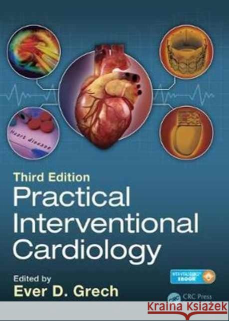 Practical Interventional Cardiology: Third Edition Ever D. Grech 9781498735094