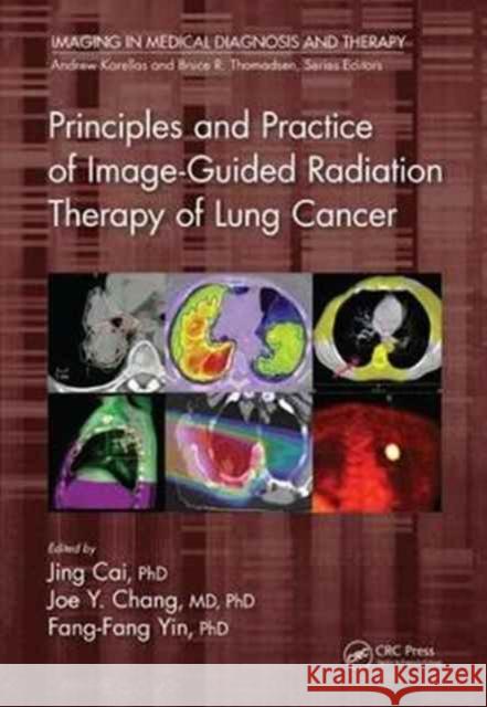 Principles and Practice of Image-Guided Radiation Therapy of Lung Cancer Jing Cai Joe Y. Chang Fang-Fang Yin 9781498736732