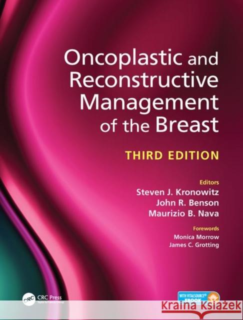 Oncoplastic and Reconstructive Management of the Breast, Third Edition Kronowitz, Steven 9781498740715 Productivity Press