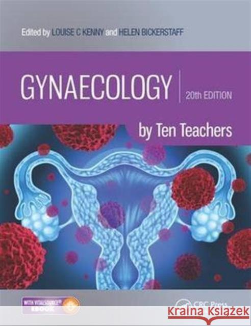Gynaecology by Ten Teachers: By Ten Teachers [With eBook] Bickerstaff, Helen 9781498744287 Taylor & Francis Inc