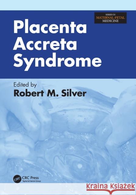 Placenta Accreta Syndrome Robert M. Silver 9781498745963 CRC Press