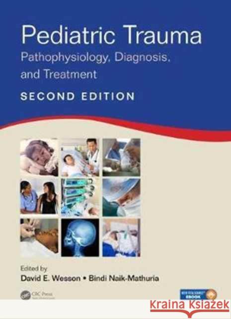 Pediatric Trauma: Pathophysiology, Diagnosis, and Treatment, Second Edition David E. Wesson Bindi Naik-Mathuria 9781498749237 CRC Press