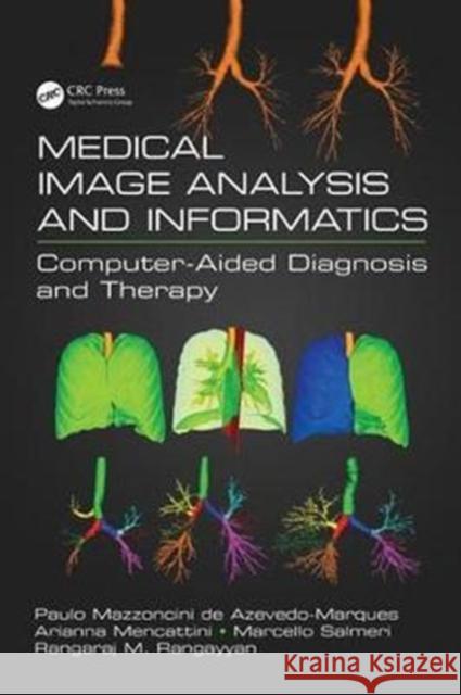 Medical Image Analysis and Informatics: Computer-Aided Diagnosis and Therapy Paulo Mazzoncini D Arianna Mencattini Marcello Salmeri 9781498753197