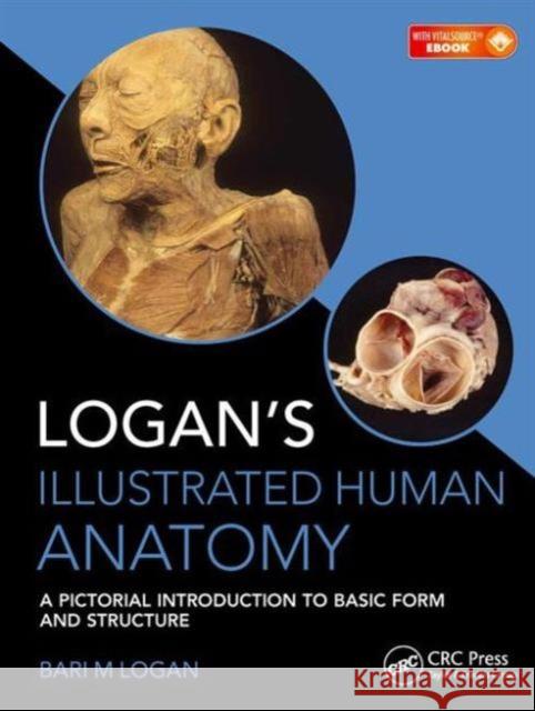 Logan's Illustrated Human Anatomy: A Pictorial Introduction to Basic Form and Structure Logan, Bari M. 9781498755306 CRC Press