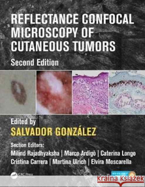 Reflectance Confocal Microscopy of Cutaneous Tumors Salvador Gonzaalez 9781498757607 CRC Press
