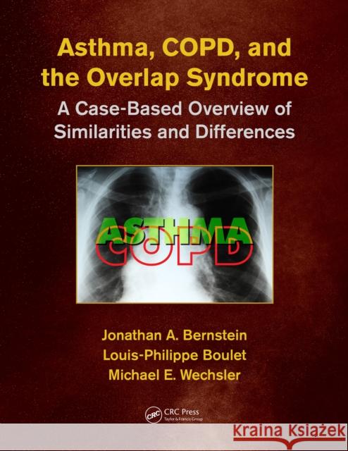Asthma, Copd, and Overlap: A Case-Based Overview of Similarities and Differences Jonathan A. Bernstein Louis-Philippe Boulet Michael E. Wechsle 9781498758413