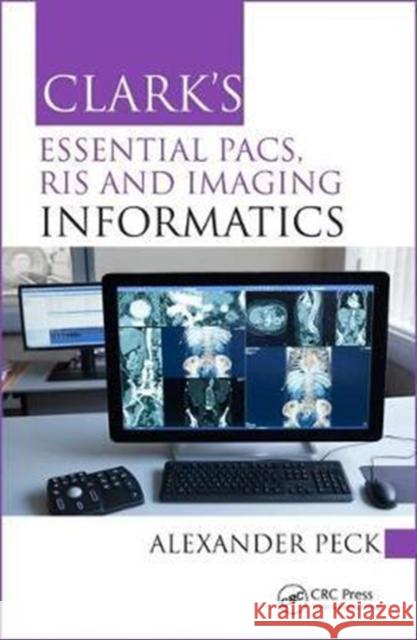 Clark's Essential Pacs, Ris and Imaging Informatics Alexander Peck 9781498763233