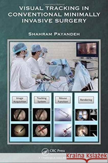 Visual Tracking in Conventional Minimally Invasive Surgery Shahram Payandeh 9781498763950 CRC Press