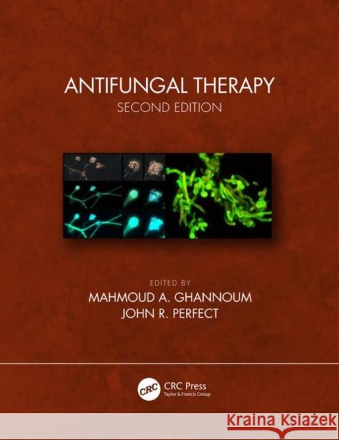 Antifungal Therapy Ghannoum, Mahmoud A. 9781498768146 CRC Press