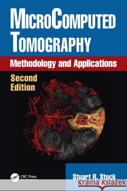 Microcomputed Tomography: Methodology and Applications, Second Edition Stuart R. Stock 9781498774970