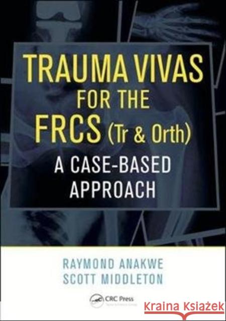 Trauma Vivas for the Frcs: A Case-Based Approach Raymond Anakwe Scott Middleton 9781498780971 CRC Press