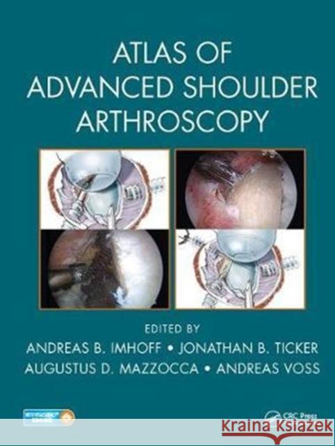 Atlas of Advanced Shoulder Arthroscopy  9781498787482 