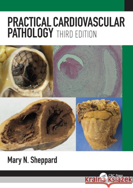 Practical Cardiovascular Pathology Sheppard, Mary N. 9781498787550