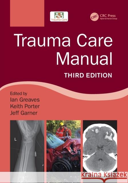 Trauma Care Manual Greaves, Ian 9781498788847 CRC Press