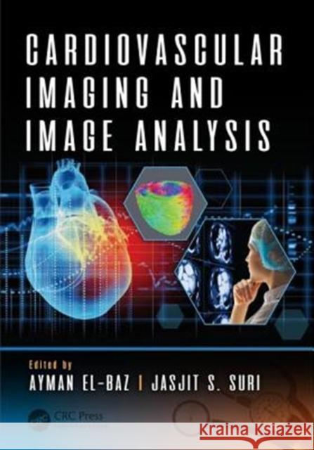 Cardiovascular Imaging and Image Analysis Ayman El-Baz (University of Louisville,  Jasjit S. Suri (Global Biomedical Techno  9781498797580
