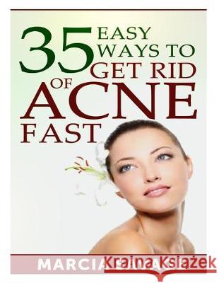 35 Easy Ways To Get Rid Of Acne Fast Marcia Savage 9781499235432