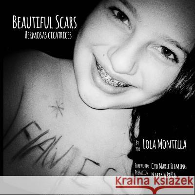 Beautiful Scars Hermosas Cicatrices Lola Montilla Cyd Marie Fleming Marina Pena 9781499360783 Createspace Independent Publishing Platform