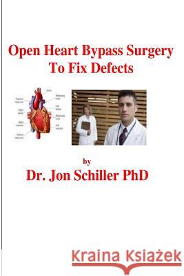 Open Heart Bypass Surgery to Fix Defects Jon Schiller 9781499548303 Createspace