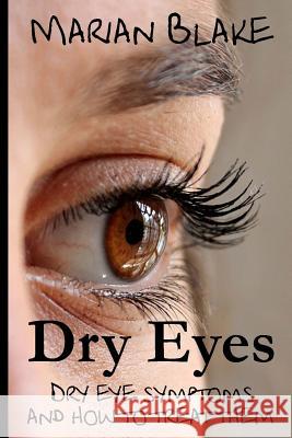 Dry Eyes: Dry Eye Symptoms and how to treat them Blake, Marian 9781499712629 Createspace