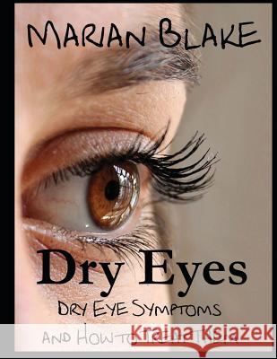 Dry Eyes (Large Print): Dry Eye Symptoms and how to treat them Marian Blake 9781500149147 Createspace Independent Publishing Platform