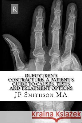 Dupuytren's Contracture: : A Patient's Guide to Causes, Tests and Treatment Option J. P. Smithso H. M. Ga 9781500613563 Createspace