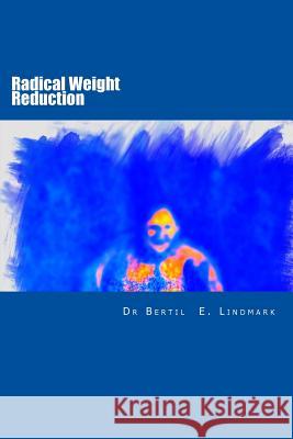 Radical Weight Reduction: all you need to know Lindmark MD Phd, Bertil E. 9781500902629 Createspace