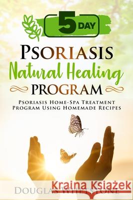 5-Day Psoriasis Natural Healing Program: Psoriasis Home-Spa Treatment Program Using Homemade Recipes Douglas Whetstone 9781500953348 Createspace
