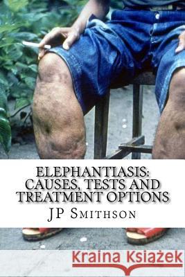 Elephantiasis: Causes, Tests and Treatment Options Jp Smithso Mark Green 9781501042096 Createspace