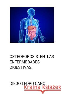 Osteoporosis en las enfermedades digestivas. Ledro-Cano, Diego 9781502312006