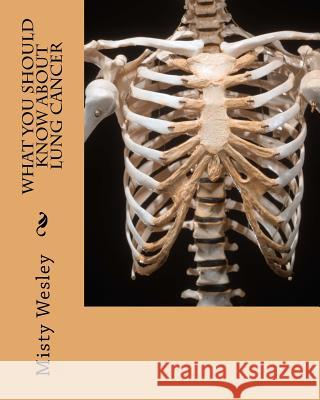 What you should know about Lung Cancer Wesley, Misty L. 9781503184893 Createspace
