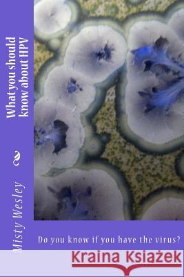 What you should know about HPV: Do you know if you have the virus? Misty Lynn Wesley 9781503369597 Createspace Independent Publishing Platform
