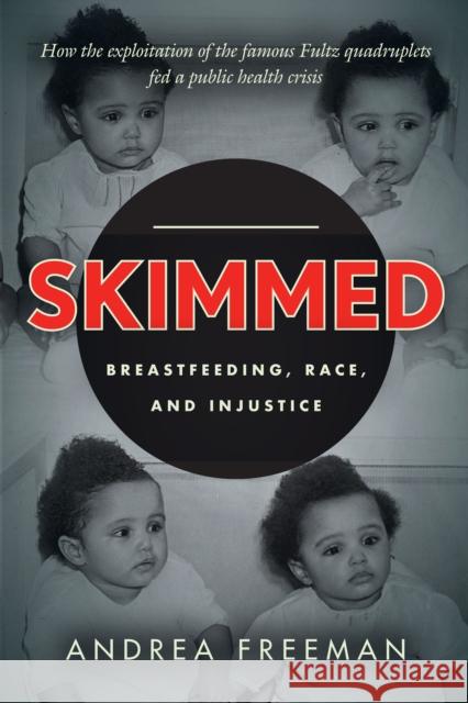 Skimmed: Breastfeeding, Race, and Injustice Freeman, Andrea 9781503601123 Stanford University Press