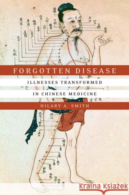 Forgotten Disease: Illnesses Transformed in Chinese Medicine Hilary A. Smith 9781503602090 Stanford University Press