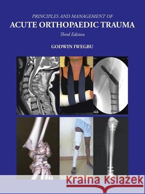 Principles and Management of Acute Orthopaedic Trauma: Third Edition Godwin Iwegbu 9781504915168