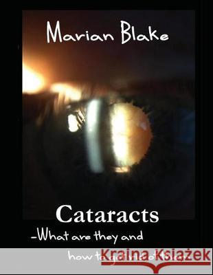 Cataracts: What are they and how to get rid of them? Blake, Marian 9781507738795 Createspace Independent Publishing Platform