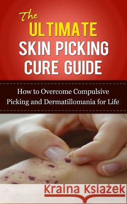 The Ultimate Skin Picking Cure Guide: How to Overcome Compulsive Picking and Dermatillomania for Life Caesar Lincoln 9781507845332 Createspace