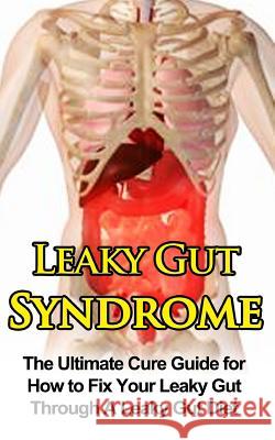 Leaky Gut Syndrome: The Ultimate Cure Guide for How to Fix Your Leaky Gut Through A Leaky Gut Diet Migan, Wade 9781507876954 Createspace