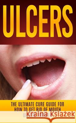 Ulcers: The Ultimate Cure Guide for How to Get Rid of Mouth Ulcers Instantly Wade Migan 9781507877081 Createspace