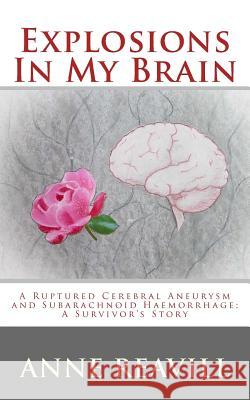 Explosions in My Brain: A Ruptures Cerebral Aneurysm and Subarachnoid Haemorrhage; A Surviver's Story Anne Reavill 9781508507369 Createspace