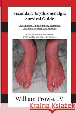 Secondary Erythromelalgia Survival Guide William E. Prows Lillie Lemon 9781508540809 Createspace