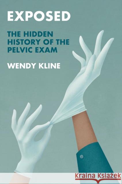 Exposed: The Hidden History of the Pelvic Exam Wendy Kline 9781509552665