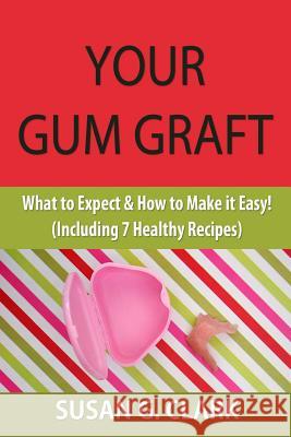 Your Gum Graft: What to Expect & How to Make it Easy! (Including 7 Healthy Recipes) Clark, Susan G. 9781511472302 Createspace