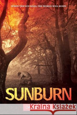 Sunburn Darren Dash 9781511568807 Createspace