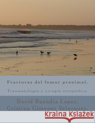 Fracturas del femur proximal. Gimenez Velazquez, Cristina 9781511941242 Createspace