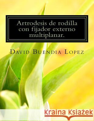 Artrodesis de rodilla con fijador externo multiplanar. Buendia Lopez, David 9781511963374 Createspace