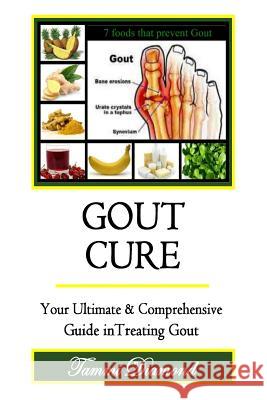 Gout Cure: Your Ultimate and Comprehensive Guide in Treating Gout Tammi Diamond 9781514629734 Createspace